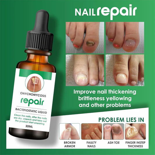 DamageFix™ Nail Repair Serum
