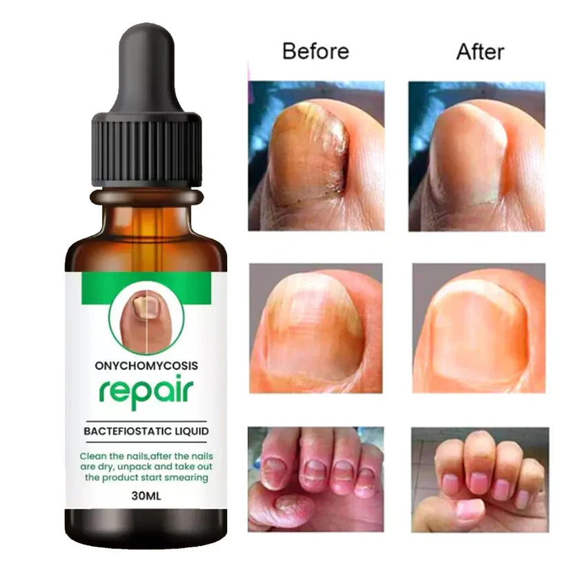 DamageFix™ Nail Repair Serum