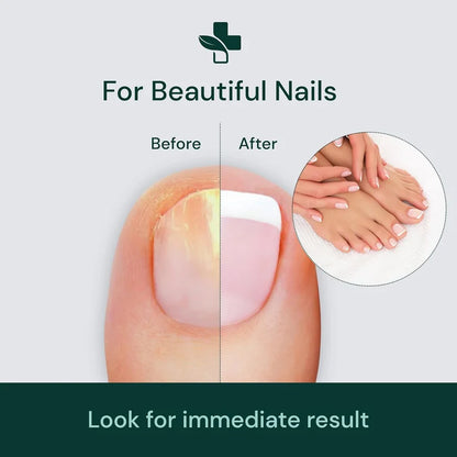 DamageFix™ Nail Repair Serum