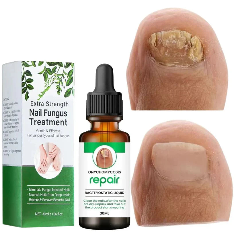 DamageFix™ Nail Repair Serum
