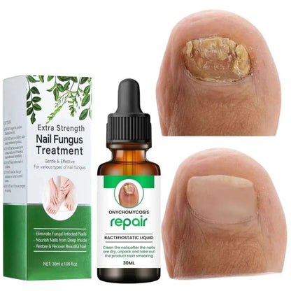 DamageFix™ Nail Repair Serum